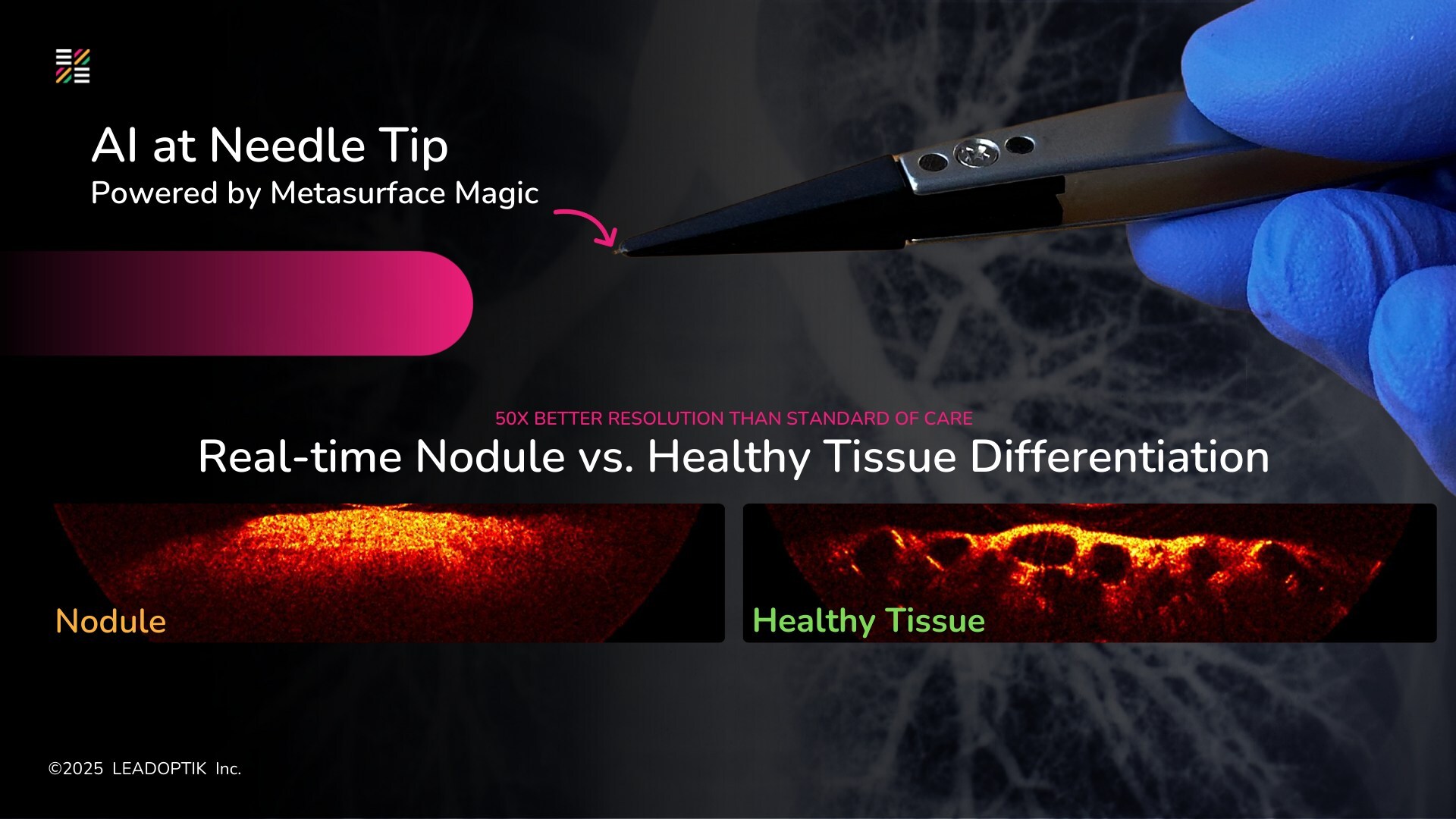 Stanford Medicine and LEADOPTIK Announce Research Collaboration to Advance AI-Enhanced, Real-Time Optical Imaging in Lung Cancer Biopsy
